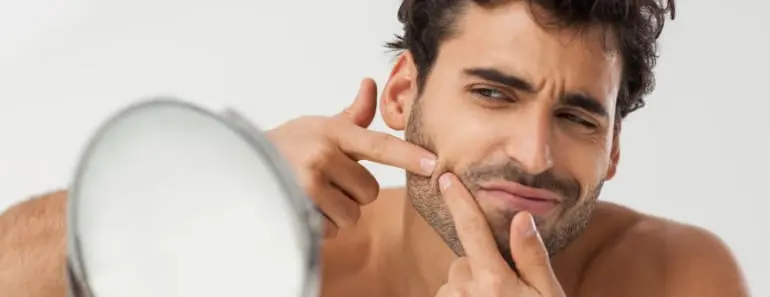 What Are Your Persistent Pimples Telling You About Your Health?